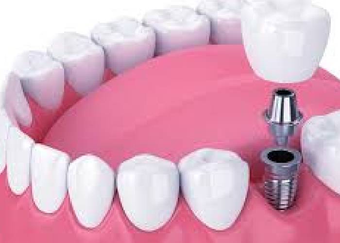 Briggs Chaney Dental Care